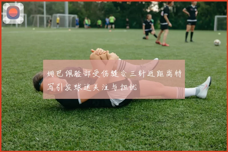 姆巴佩脸部受伤缝合三针近距离特写引发球迷关注与担忧